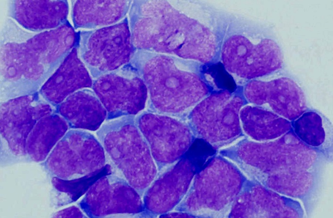 Solukuoleman löytö voi tukea syöpälääkkeiden kehittämistä: tutkimus 1