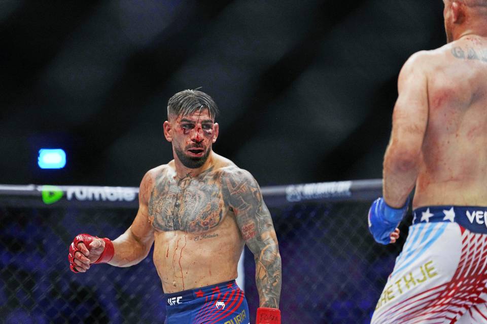 UFC-tähti rikkoi hiljaisuuden Valkoisessa talossa tapahtuneen väkivallan jälkeen: "Sanoit jättäväsi jälkesi kasvoihini – ja teit sen" UFC-tähti rikkoi hiljaisuuden Valkoisessa talossa tapahtuneen väkivallan jälkeen: "Sanoit jättäväsi jälkesi kasvoihini – ja teit sen" 1