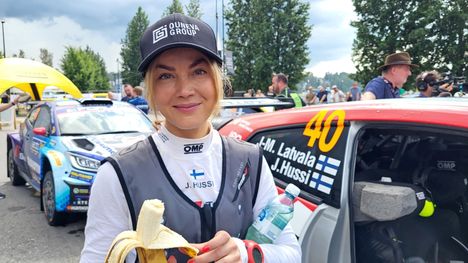 Janni Hussi julkaisi kasvojensa ruusufinniä kuvaavat kuvat 2 Janni Hussi julkaisi kasvojensa ruusufinniä kuvaavat kuvat 1