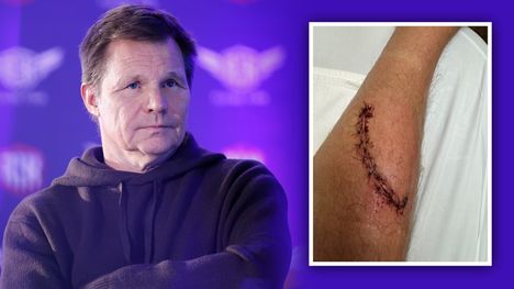 Mika Salo kommentoi puukotustaan – rujot kuvat julki 1